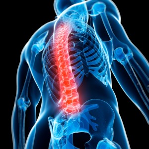 spinal tumor surgery